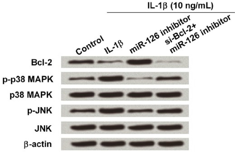 Fig. 5 
            miR-126 regulated Bcl-2 expression via inactivating the MAPK/JNK signaling pathway. The human chondrocyte cell line CHON-001 was exposed to IL-1β (10 ng/ml), and then transfected with miR-126 inhibitor and/or Bcl-2 siRNA (si-Bcl-2). Expression of Bcl-2, phosphorylated (p)-p38 MAPK, p38 MAPK, p-JNK, and JNK were measured by Western blot. β-actin acted as an internal control.
          