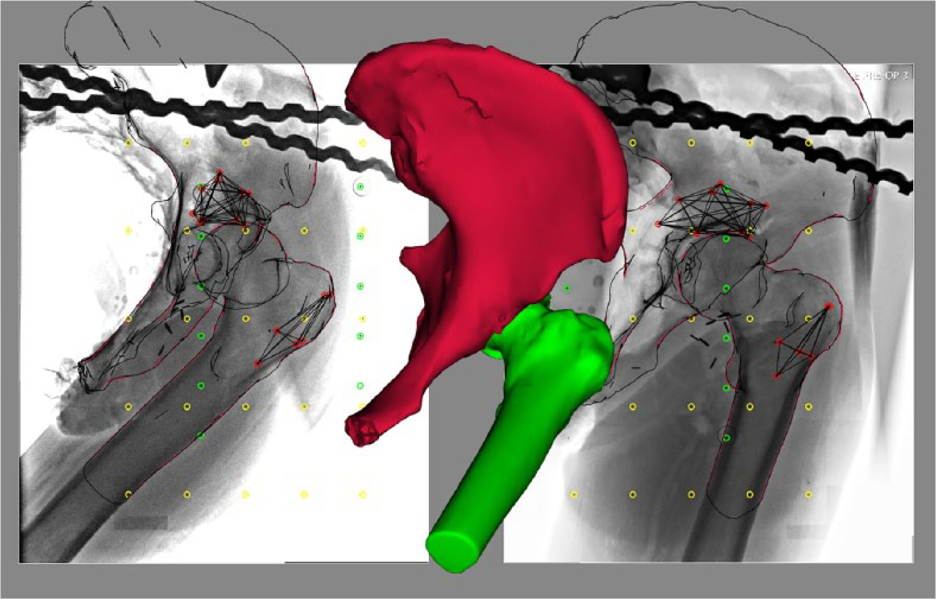 Fig. 3 
            Bone models fitted by projection to the radiographical contours in model-based radiostereometric software (RSAcore, Leiden, Netherlands). Control and fiducial markers in the calibration box are identified and labelled with green and yellow circles respectively.
          