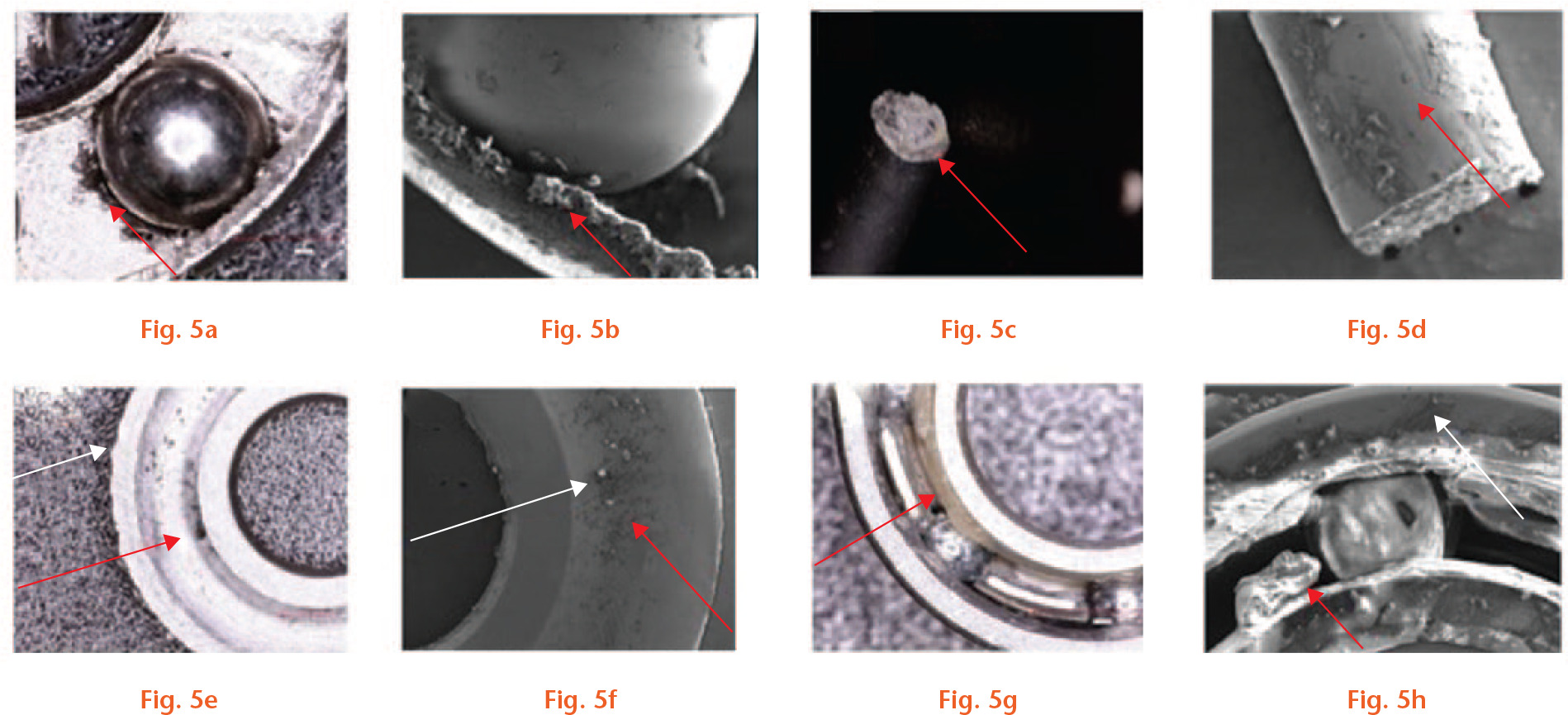  
            Microscopic inspection of internal parts of early P1 design. a) Microscopic picture of the ball bearing where black debris was found (arrow). b) Scanning electron microscopy (SEM) with presence of foreign materials on the ball bearing (arrow). c) Fractured site of the pin (arrow) showing a brittle fracture with no evident initiation or end points of the crack. d) SEM showed the rough surface of the fracture, combined with black debris on the side of the actuator pin (arrow). e) Black deposits on the plain bearings (red arrow) and fretting more prominent on the exterior part of the bearing (white arrow). f) SEM revealed black debris (red arrow) and biological material (fluorescent debris, indicated by the white arrow). g) The ball bearing previously situated at the bottom of the gearbox had a fat-like substance (arrow), most likely lubricant to facilitate motion within the internal mechanism. h) SEM confirmed the presence of fat-like substance (red arrow) and black debris (white arrow).
          