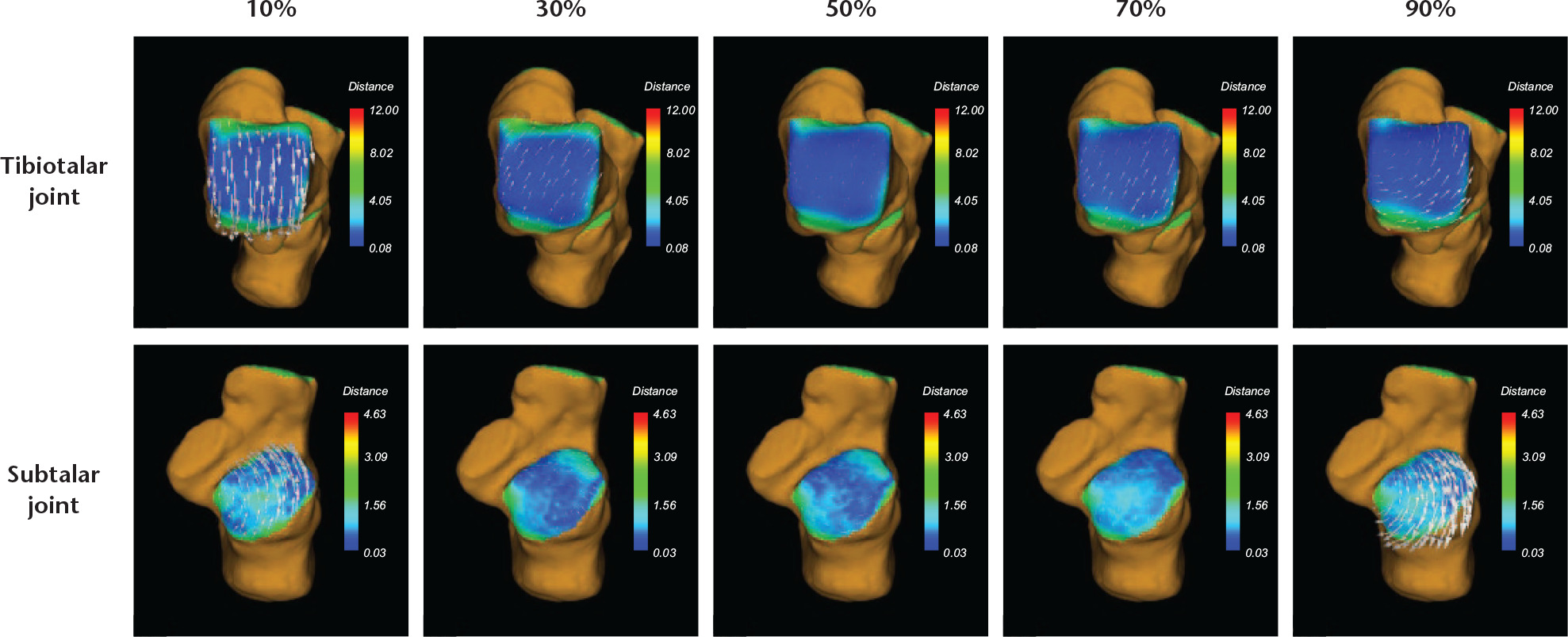 Fig. 4 
          Surface relative velocity vectors (SRVVs) in the talar dome (top row) and posterior facet of the calcaneus (bottom row) were calculated at 10% intervals to quantify the relative contact movements in the tibiotalar and subtalar joints during walking. Here, we presented the results only for the 10%, 30%, 50%, 70%, and 90% timepoints. The colours on the map represent distances on the contact surface.
        