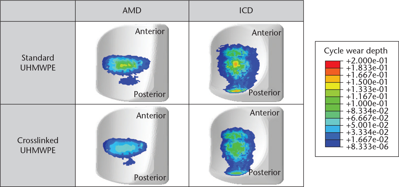 Fig. 5 
          Predicted wear contour for the two different tibial insert designs with two different materials during gait cycle. AMD, anatomy mimetic design; ICD, increased conformity design; UHMWPE, ultra-high-molecular-weight polyethylene.
        