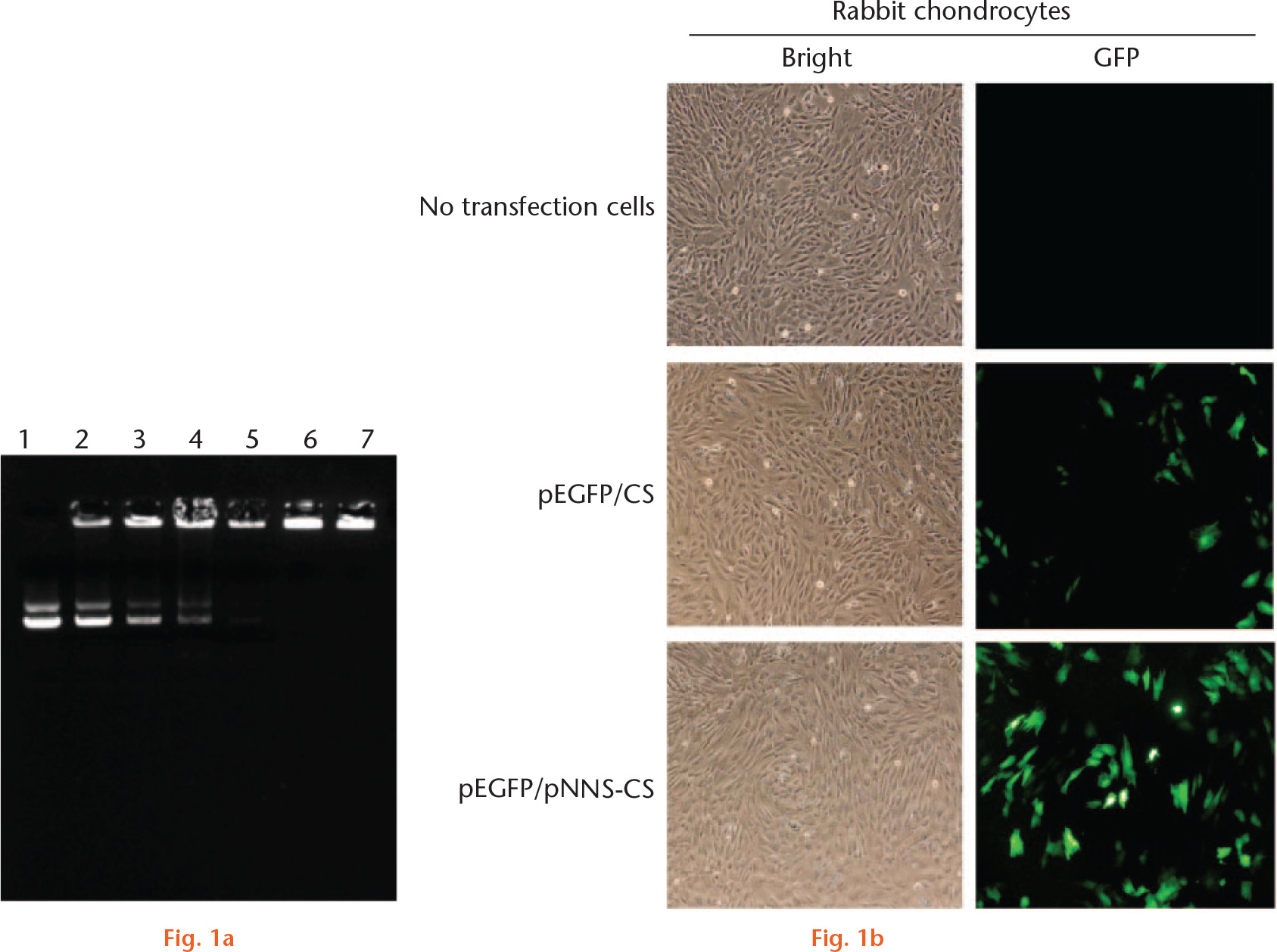 Fig. 1 
            Electrophoresis and transfection efficiency of the plasmid DNA (pDNA)/pNNS conjugated to chitosan (pNNS-CS) complex. a) Agarose gel electrophoresis of the pDNA/pNNS-CS complexes. Lane 1: free pDNA; lanes 2 to 7: pDNA/pNNS-CS (w/w) = 1:0.25; 1:0.5; 1:1; 1:1.5; 1:2; 1:2.5. When pDNA/pNNS-CS reached a weight ratio of 1:2, these complexes lost their mobility in the gel. b) The transfection efficiency of pDNA/pNNS-CS and pDNA/CS complexes in rabbit chondrocytes. Chondrocytes were transfected with pEGFP/pNNS-CS and pEGFP/CS for 72 hours; then green fluorescent protein (GFP) was observed under a fluorescence microscope (100×).
          