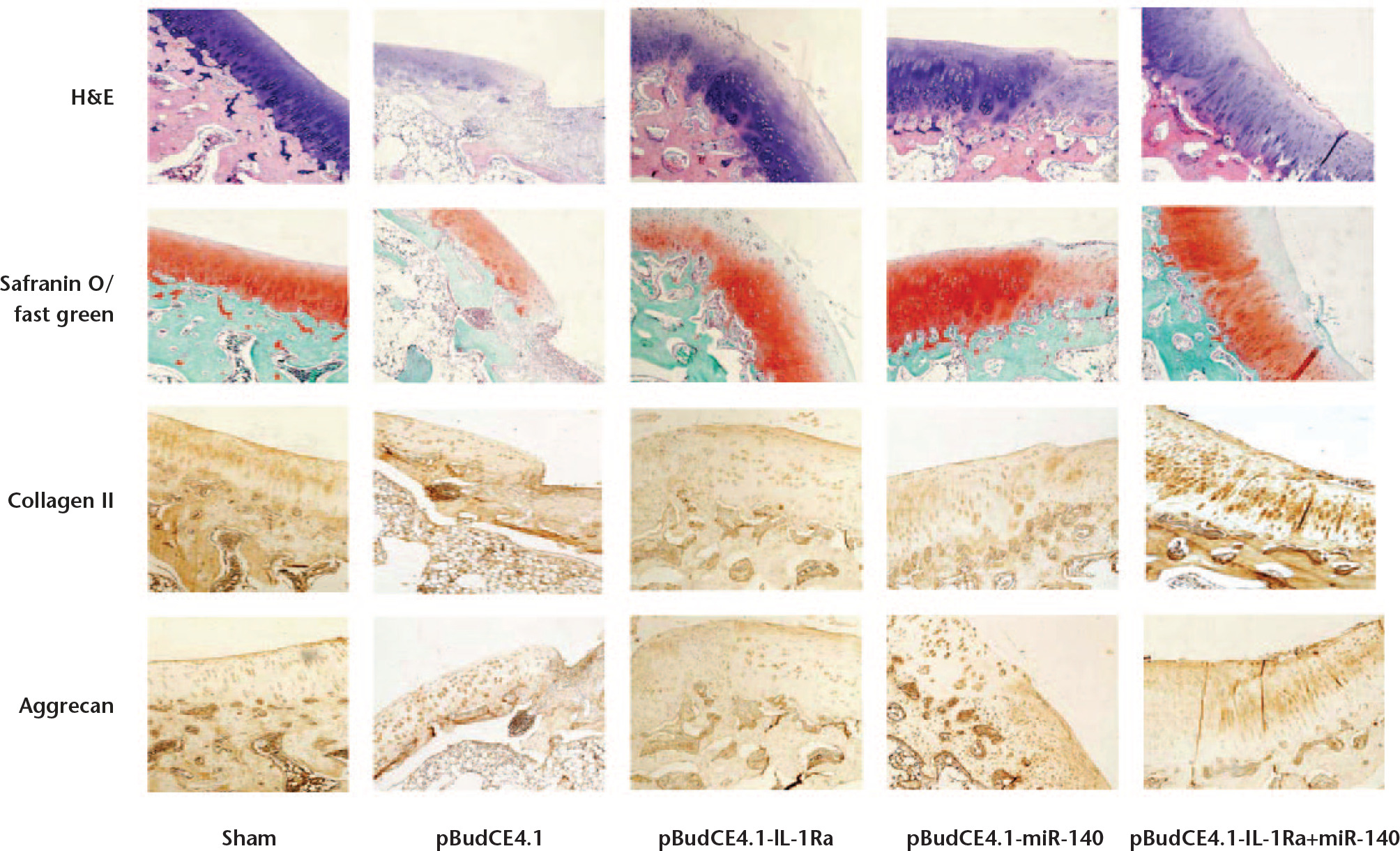 Fig. 7 
            Histological analysis of changes in rabbit articular cartilage. Eight weeks after surgery, the rabbits were sacrificed, and the sagittal medial femoral condyles of knee were stained with haematoxylin and eosin (H&E), safranin O/fast green, collagen II, and aggrecan. The data shown are representative microscopic images of rabbit knees from each group (original magnification 40×).
          