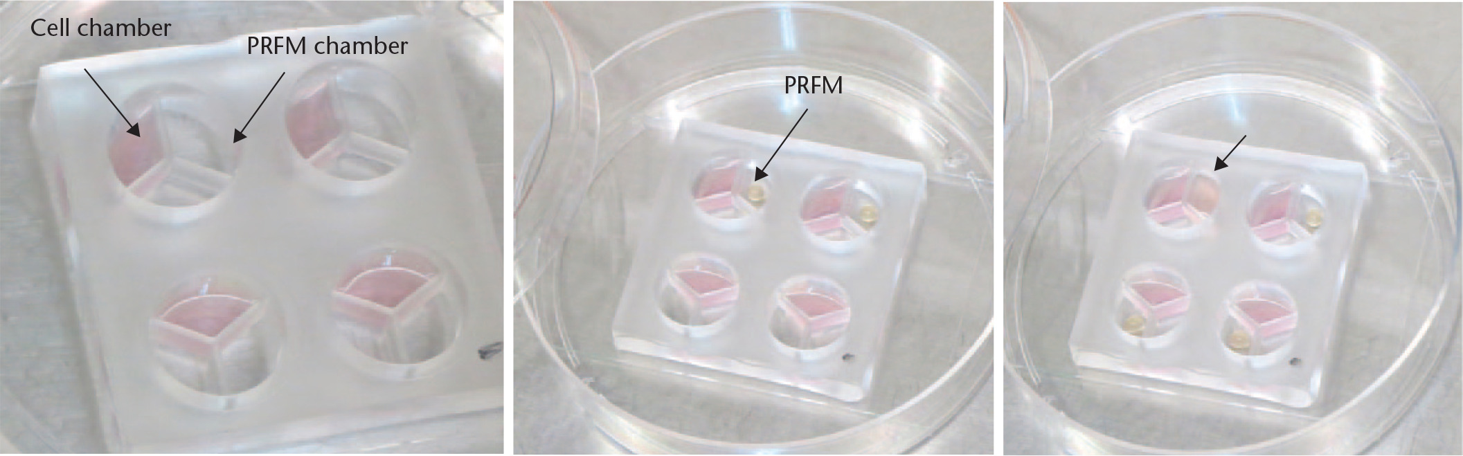 Fig. 2 
            The co-culture device design. a) Tenocytes seeded in the cell chamber. b) Platelet-rich fibrin matrix (PRFM) was added into the PRFM chamber to avoid the gelling effect. c) Culture medium (arrow) was added into the PRFM chamber until the fluid level crossed over the separation polydimethylsiloxane (PDMS) barrier, causing growth factors dispersed in the culture medium to be disseminated to the cell chamber to stimulate tenocyte proliferation.
          
