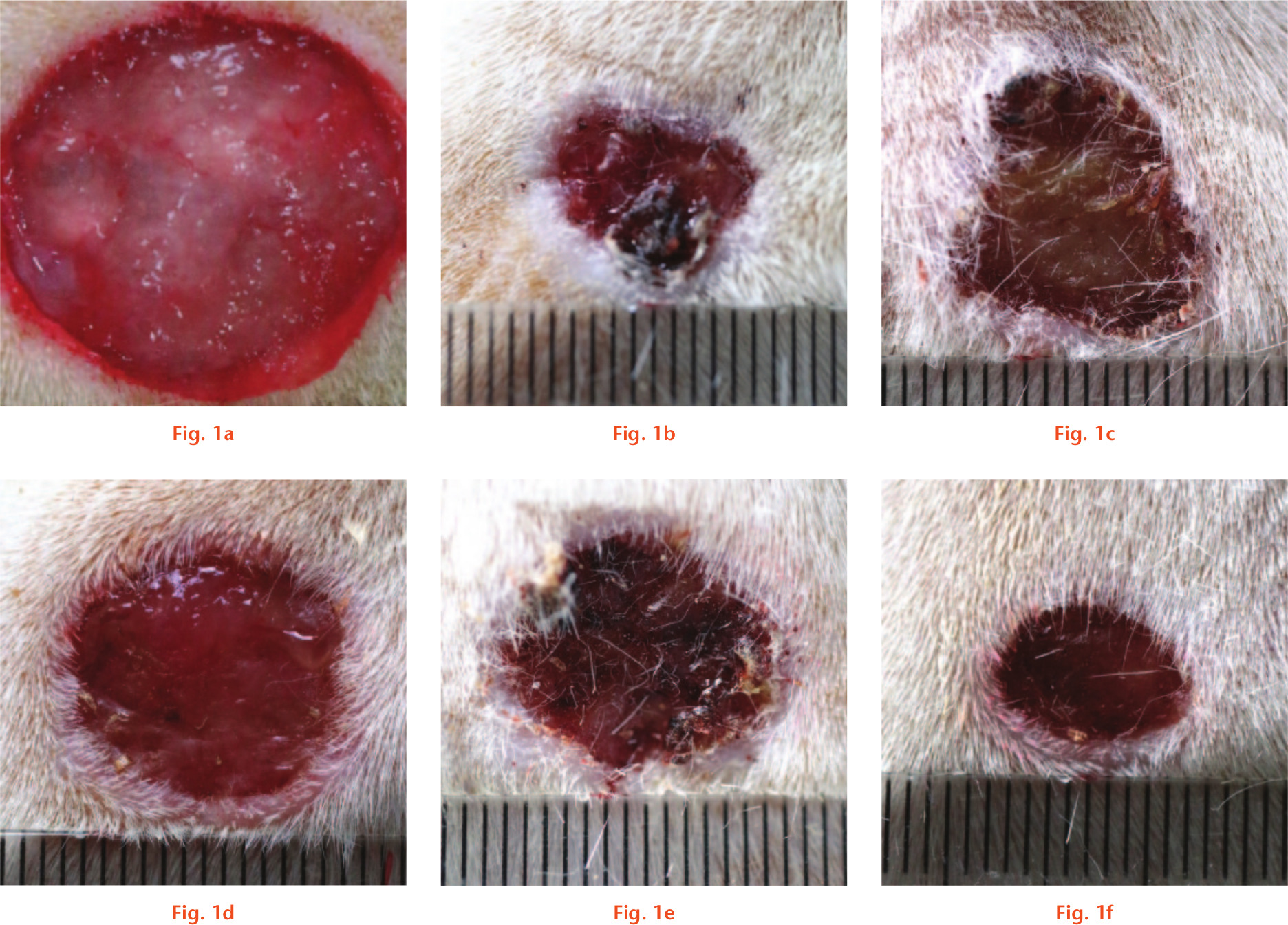 Fig. 1 
            Images of wounds before and after two weeks. a) The original wound was created in an 18 mm size. The wounds were then irrigated daily for two weeks with: b) normal saline; c) castile soap; d) benzalkonium chloride; e) bacitracin; and f) ethylenediaminetetraacetic acid (EDTA).
          
