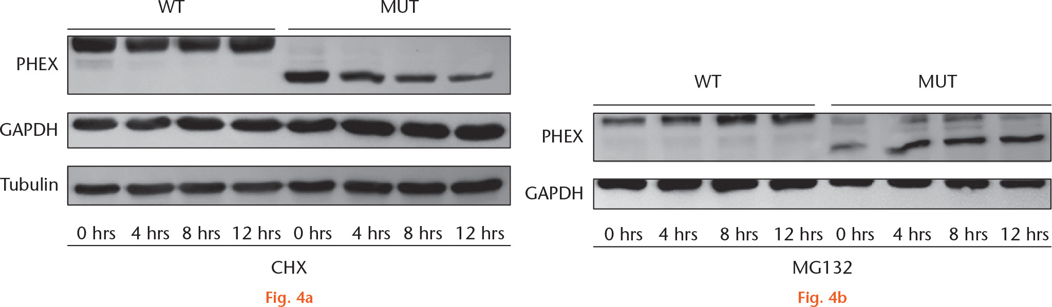 Fig. 4 
            Mutant (MUT) phosphate-regulating neutral endopeptidase, X-linked (PHEX) protein degrades more rapidly than wild-type (WT) protein. a) PHEX bands at baseline, four hours, eight hours, and 12 hours with cycloheximide (CHX) treatment. b) PHEX bands at baseline, four hours, eight hours, and 12 hours with MG132 treatment. GADPH, glyceraldehyde 3-phosphate dehydrogenase.
          
