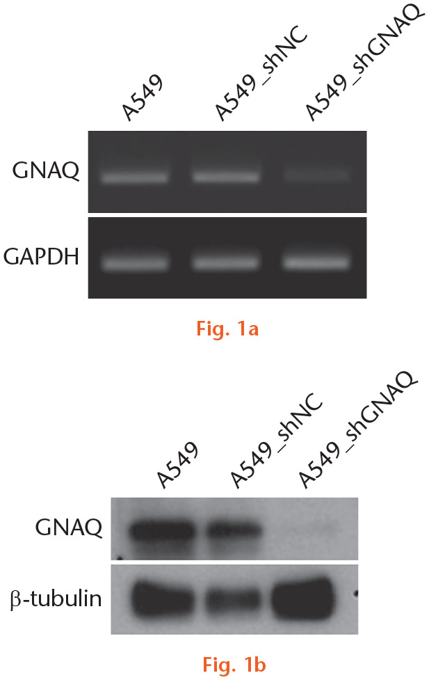  
            Stable knockdown of guanine nucleotide-binding protein G(q) subunit alpha (GNAQ) in A549 cells. GNAQ short hairpin RNA lentiviral vector (A549_shGNAQ) and short hairpin RNA negative control lentiviral vector (A549_shNC) were constructed. The vectors were transfected into A549 cells. a) Messenger RNA and b) protein levels of GNAQ were assessed using semi-quantitative polymerase chain reaction and western blot assay, respectively. GAPDH, glyceraldehyde 3-phosphate dehydrogenase.
          