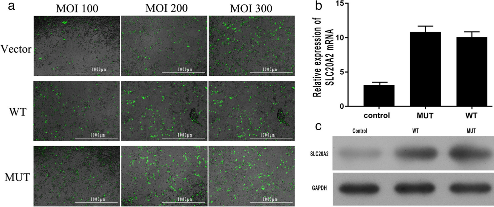 Fig. 2 
            a) An immunofluorescence examination (magnification: 40×) was performed to determine the transfection efficiency of the cell lines. Three different quantities of pcDNA3.0 plasmids were used to achieve the multiplicity of infection (MOI) of 100, 200, and 300. The results indicate that all the cell lines with a MOI of 300 had the best transfection efficiency (the green fluorescence shows the transfected plasmids). Scale bar = 1,000 μm. b) and c) Expression of solute carrier family 20 member 2 (SLC20A2), as determined by b) quantitative real-time polymerase chain reaction (qRT-PCR) and c) western blot. There was no significant difference in SLC20A2 expression level between the wild-type (WT) and mutant (MUT) groups. GAPDH, glyceraldehyde 3-phosphate dehydrogenase; mRNA, messenger RNA.
          