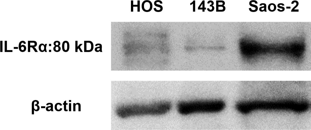 Fig. 2 
            Representative western blot images showing expression of interleukin-6 receptor-alpha (IL-6Rα) in 143B, HOS, and Saos-2 cells.
          