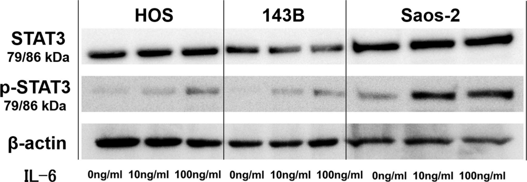 Fig. 3 
            Representative western blot images showing effect of interleukin-6 (IL-6) on phosphorylation of signal transducer and activator of transcription 3 (STAT3) in 143B, HOS, and Saos-2 cells. p-STAT3, phospho-STAT3.
          