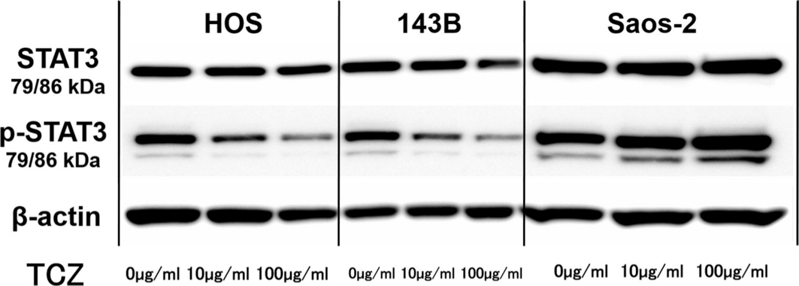 Fig. 6 
            Representative western blot images showing effect of tocilizumab (TCZ) treatment on phosphorylation of signal transducer and activator of transcription 3 (STAT3) in 143B, HOS, and Saos-2 cells with recombinant human interleukin-6 (IL-6). p-STAT3, phospho-STAT3.
          