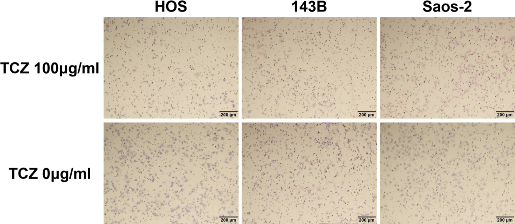 Fig. 7 
            Upper row shows the effect of tocilizumab (TCZ) treatment on invasion of 143B, HOS, and Saos-2 cells. Lower row shows the invasion of 143B, HOS, and Saos-2 cells without TCZ treatment.
          