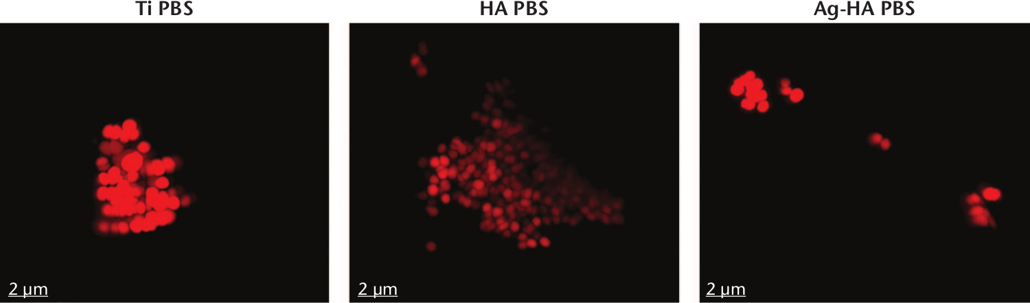 Fig. 2 
            Confocal laser scanning microscopy (CLSM) Airyscan images of calcein red-orange–stained methicillin-resistant Staphylococcus aureus (MRSA) on discs of the titanium phosphate-buffered saline (Ti PBS), hydroxyapatite PBS (HA PBS), and silver-containing HA PBS (Ag-HA PBS) groups. The biofilms in the Ti PBS group were clumped and unfocused, whereas those in the HA PBS group were clumped and clear. In the Ag-HA PBS group, the biofilms were scattered and unfocused. The morphological features of the biofilms were observed with a 63× oil objective lens and a zoom factor of 5.0. Scale bar = 2 µm.
          