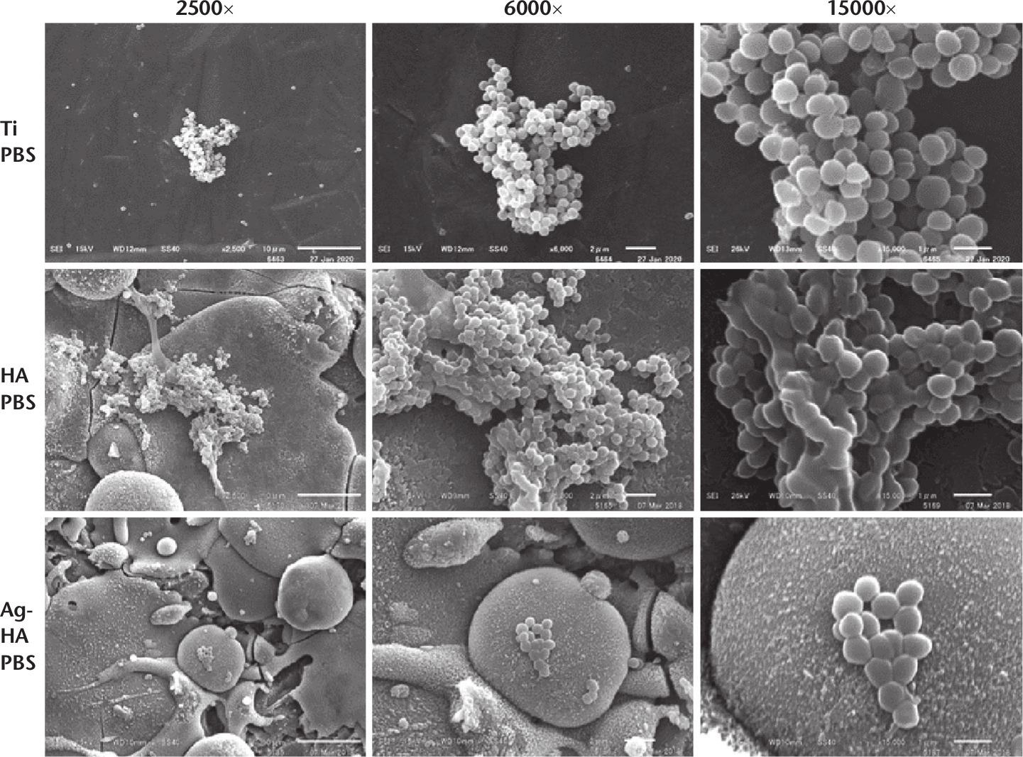 Fig. 3 
            Scanning electron microscopy (SEM) images of the methicillin-resistant Staphylococcus aureus (MRSA) biofilms in the titanium phosphate-buffered saline (Ti PBS), hydroxyapatite PBS (HA PBS), and silver-containing HA PBS (Ag-HA PBS) groups. The magnifications and corresponding scale bars were 2500× and 10 µm, 6000× and 2 µm, and 15000× and 1 µm, respectively. The biofilms in the Ti PBS group were embedded in less extracellular polymeric substance (EPS) and were large, whereas those in the HA PBS group were embedded in large quantities of EPS and were large. In the Ag-HA PBS group, the biofilms were embedded in less EPS and were small and scattered.
          