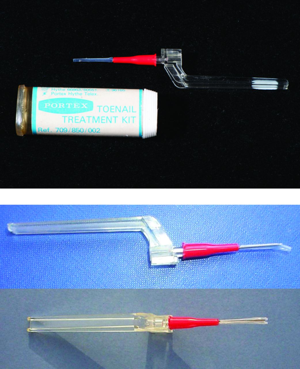 Fig. 1 
          Portex Toenail Treatment Kit (Portex 1979).
        