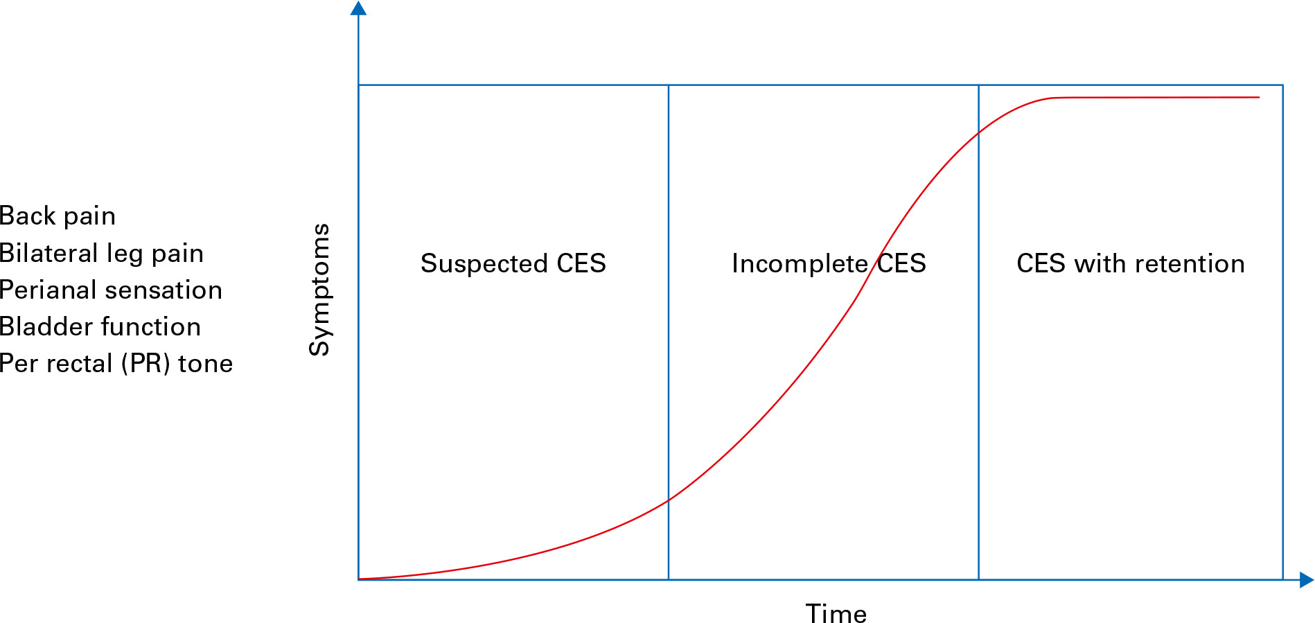 Fig. 1 
          Progression of cauda equina syndrome (CES) symptoms with time.
        
