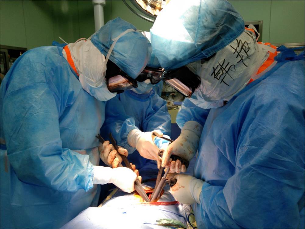 Fig. 3 
            A group of surgeries were performing a posterior lumbar surgery on a patient with COVID-19. (Provided by Dr. Y. G).
          
