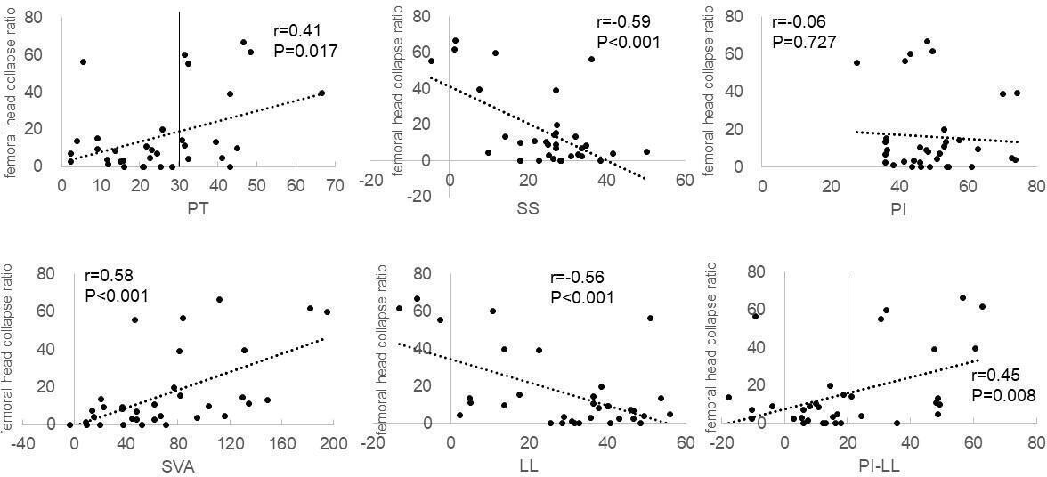 Fig. 4 
            Scatter plots of correlation between the femoral head collapse ratio and radiological parameters in patients with rapidly destructive coxopathy. Pearson’s correlation coefficients (r) are shown with p-values. LL, lumbar lordosis angle; PI, pelvic incidence; PT, pelvic tilt; SS, sacral slope; SVA, sagittal vertical axis; TK, thoracic kyphosis angle.
          