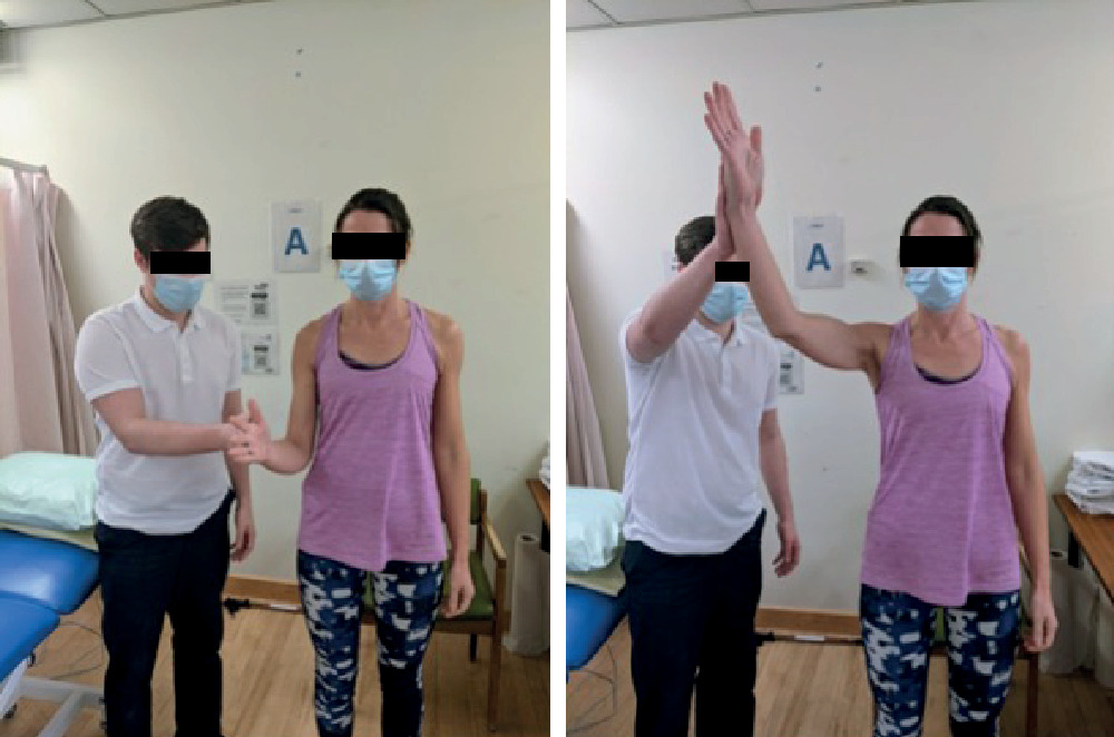 Fig. 3 
            Infraspinatus facilitation. This is the most common improvement test leading to correction of anterior sternoclavicular joint instability. The patient stands in a relaxed upright posture with their elbow bent at their side. The physiotherapist asks the patient to gently push against their hand to facilitate activation of the external rotators. The patient is then encouraged to maintain the external rotation force while elevating their arm.
          