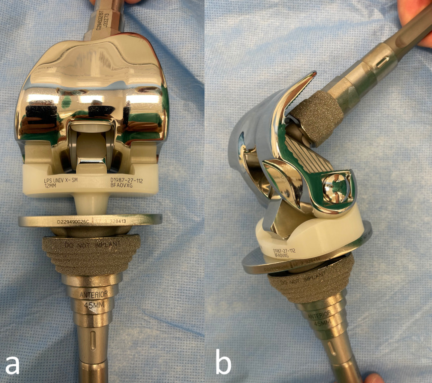 Fig. 1 
            Photographs of the S-ROM prosthesis. a) The polyethylene insert is congruent with the femoral component with a flat-on-flat articulation with the tibial tray. b) Note that there is no inherent resistance to rotation at the insert-tibial tray interface.
          