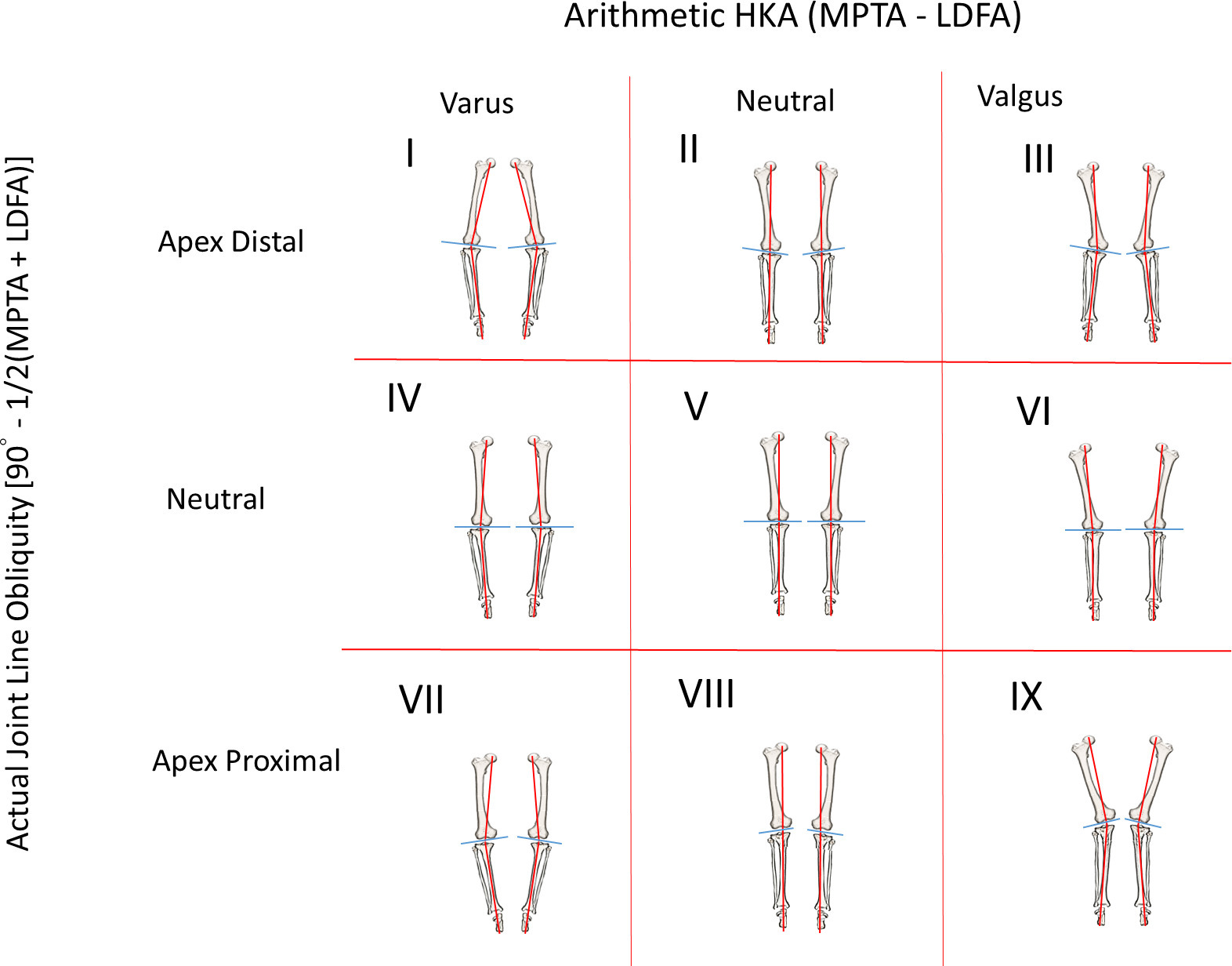 Fig. 2 
            The modified coronal plane alignment of the knee classification with nine theoretical types of knee. HKA, hip-knee-ankle angle; LDFA, lateral distal femoral angle; MPTA, medial proximal tibial angle.
          