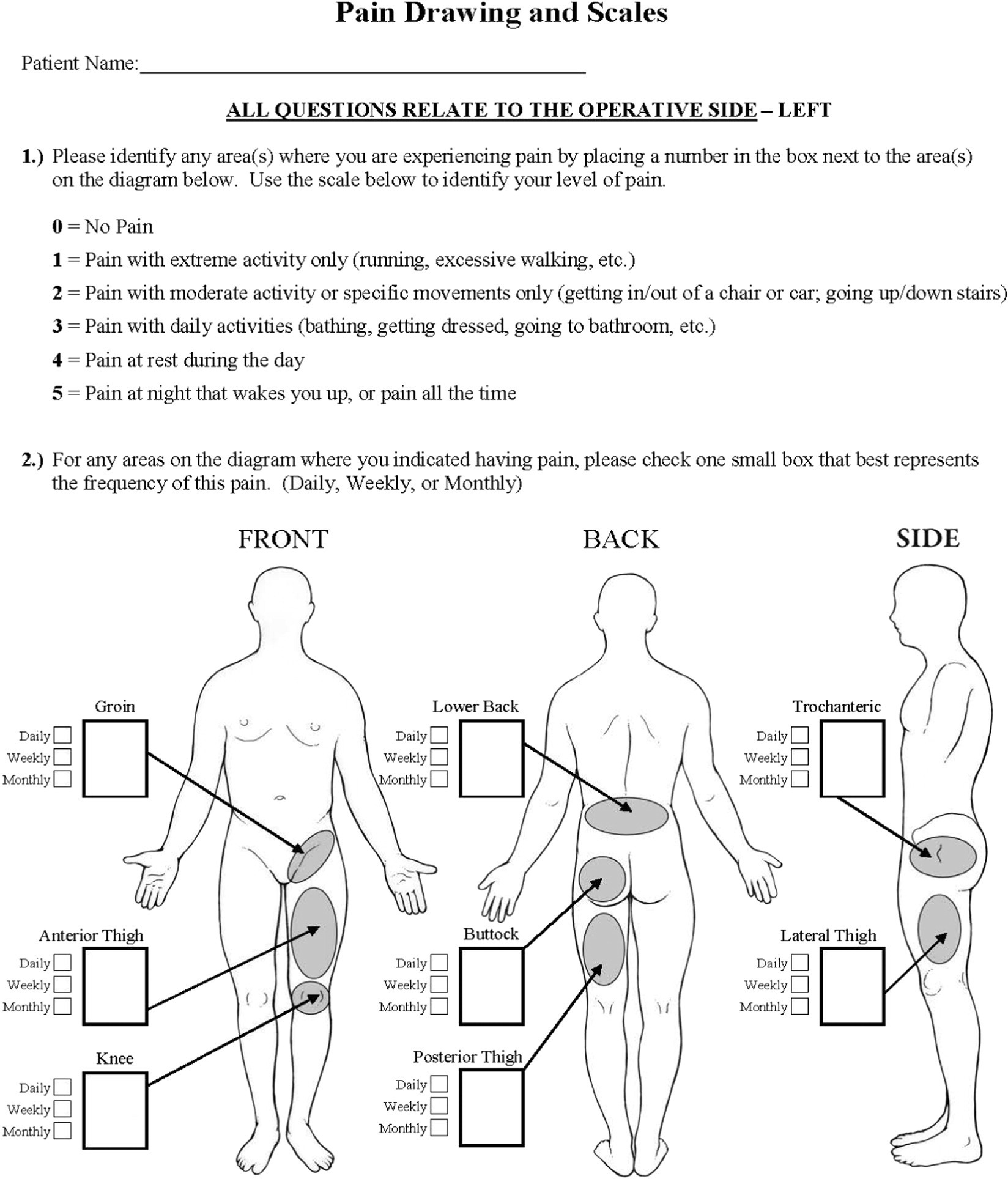 Fig. 2 
            Pain severity and locations drawing included on the hip questionnaire which was sent to potential study participants.
          