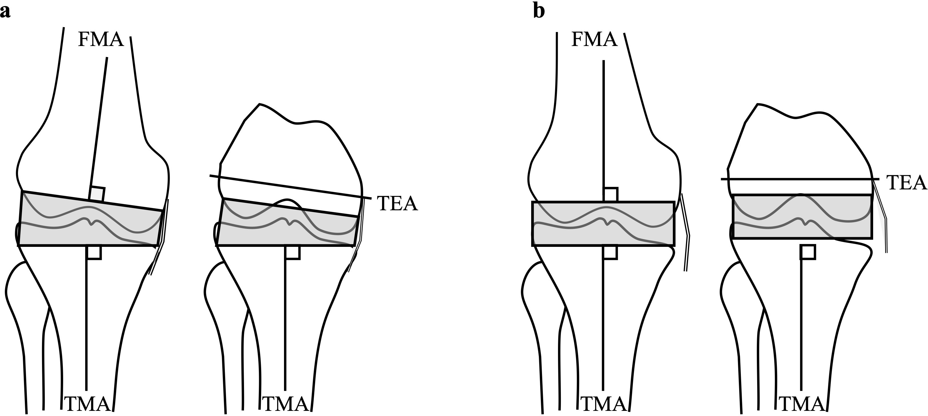 Fig. 1 
          a) The mechanical bone cut. The cutting surface is perpendicular to the femoral and tibial mechanical axis (FMA and TMA) and parallel to the transepicondylar axis (TEA). b) Soft-tissue release. Leg alignment is not always neutral and constitutional varus is prevalent, so soft-tissue release is necessary to make the rectangular gap.
        