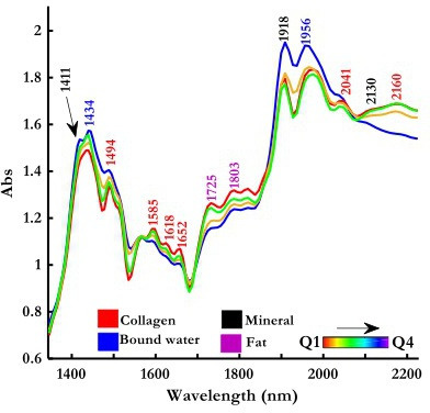Fig. 2 
            Spectral differences in sternal bone of varying bone volume fraction and their band assignments: average near-infrared spectroscopy (NIR) spectra of human sternal bone recorded by a miniature NIR spectrometer with major bands labelled. The spectra revealed in vivo bone composition, mostly bound water, inorganic mineral content approximated as hydroxyapatite (Ca10(PO4)6(OH)2)), organic component (collagen), and bone marrow (fat/lipid). The spectra were presented based on the quartile ranking of the bone volume fraction (BV/TV) parameters. Red spectrum is Q1, green is Q2, yellow is Q3, and the blue spectrum depict Q4. Abs, absorbance, Q, quartile of bone volume fraction.
          