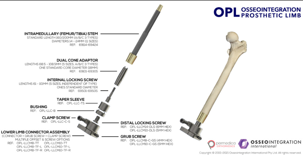 Fig. 1 
          The OPL (Osseointegration Prosthetic Limb) implant: image of the prosthetic components and schematic of the implant in a femur, from Osseointegration International.
        