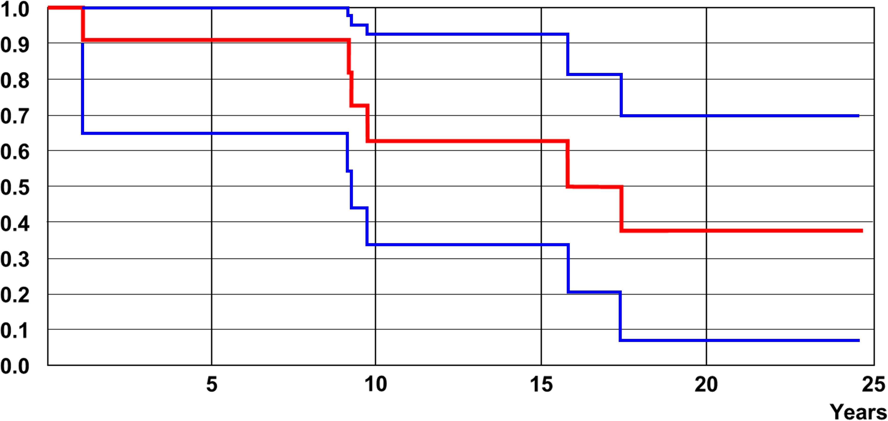 Fig. 2 
          Kaplan-Meier survivorship. Cumulative survivorship of the native hips at five years was 91% (95% confidence interval (CI) 74 to 100), at ten years was 62% (95% CI 33 to 92), and at 20 years 37% (95% CI 6 to 70). Blue lines indicate the CIs.
        