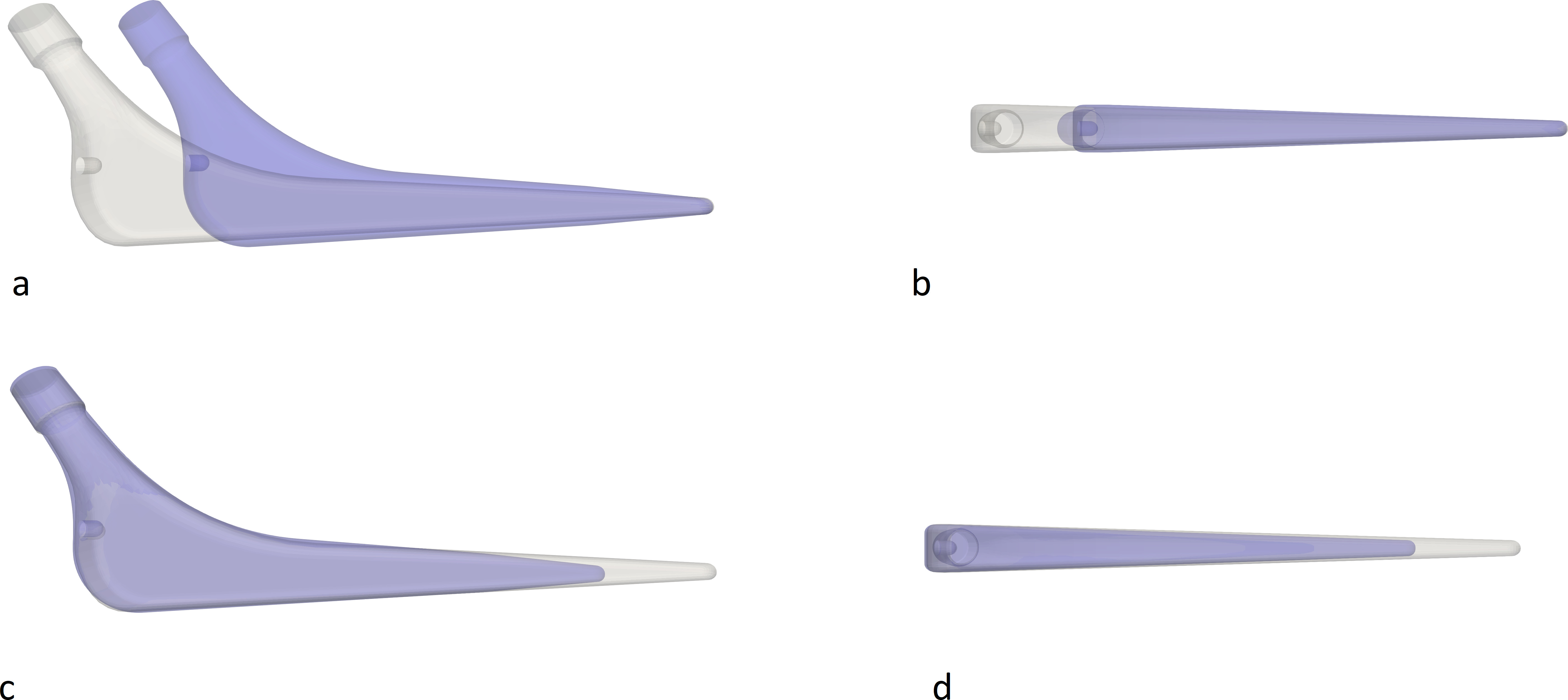 Fig. 2 
            3D models of the Exeter short stem (blue) and Exeter standard stem (grey) showns that a) and b) the short stem has a similar taper but distributed on a shorter stem (a, b), and proximal geometry similar to the standard stem (c, d).
          