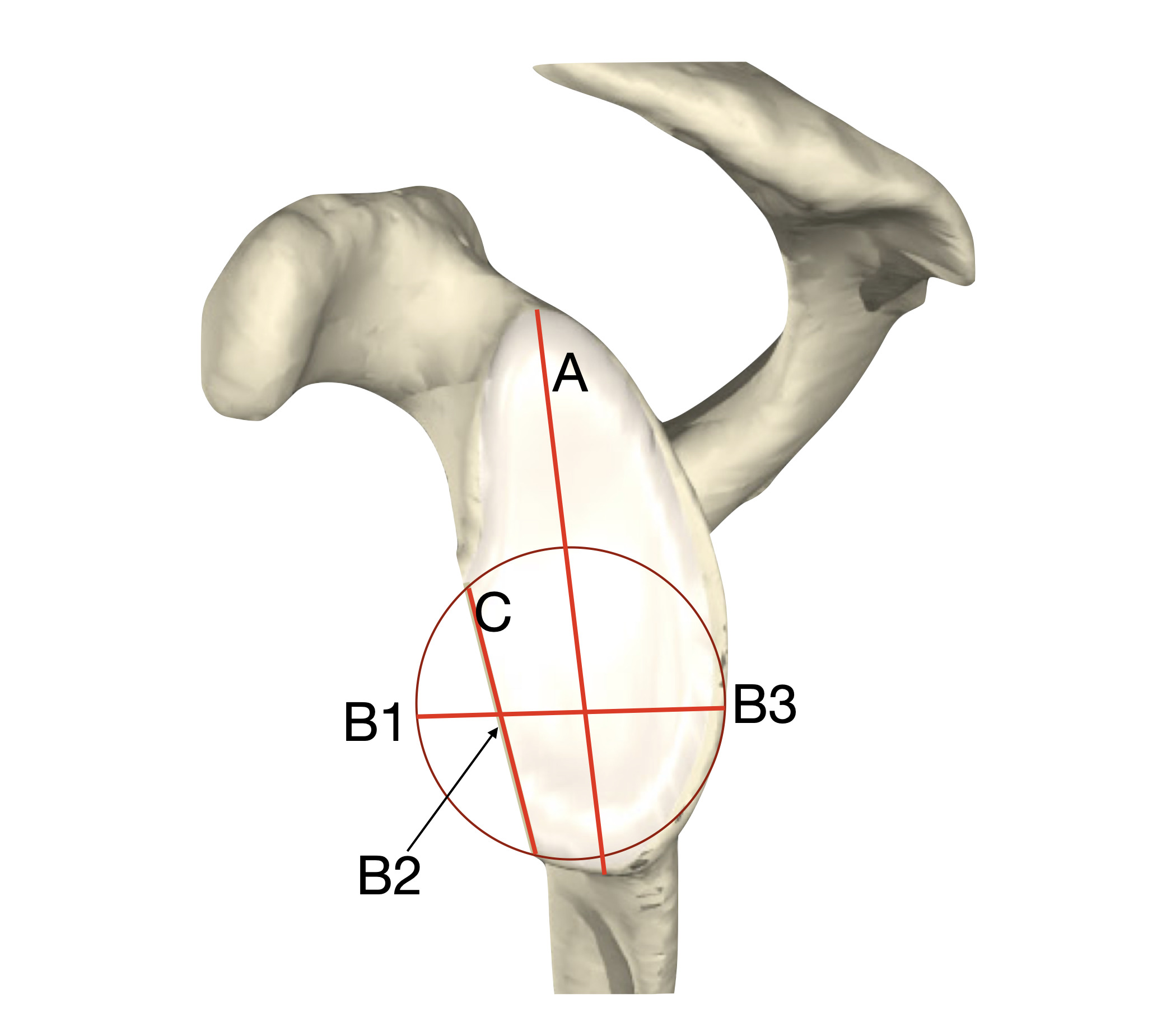 Fig. 7 
            A, B2-B3, B1-B3 and C were measured using ipsilateral circle of best fit (COBF) on two separate occasions.
          