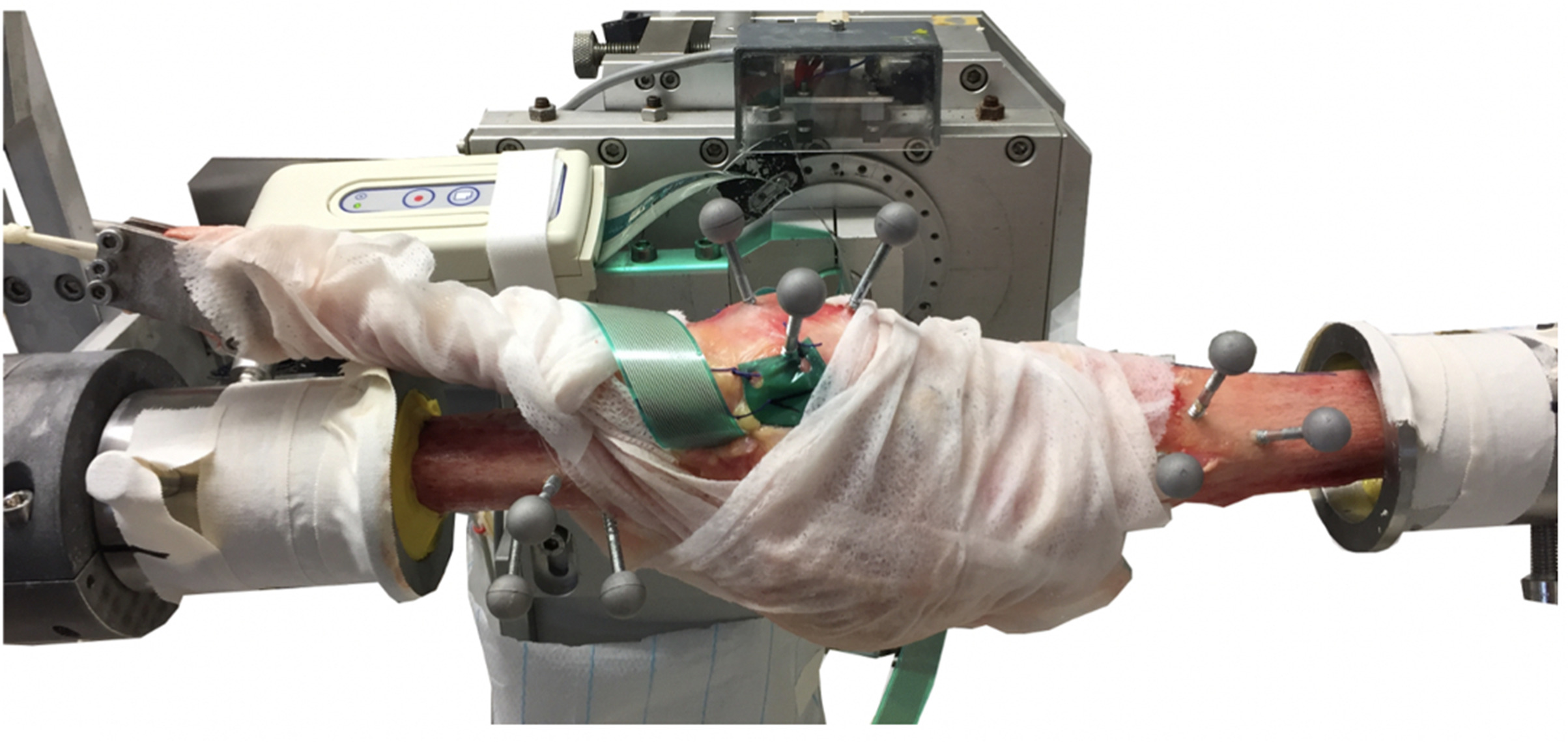 Fig. 1 
            Clamped specimen at the starting position (full extension (shown on the right side the tibia, and the top patella on the left femur)) in the knee simulator. The markers are clearly visible for the OptiTrack system (NaturalPoint, USA), the Tekscan films (Tekscan, USA) are derived via an extra PC, and the preload on the quadriceps tendon is applied.
          