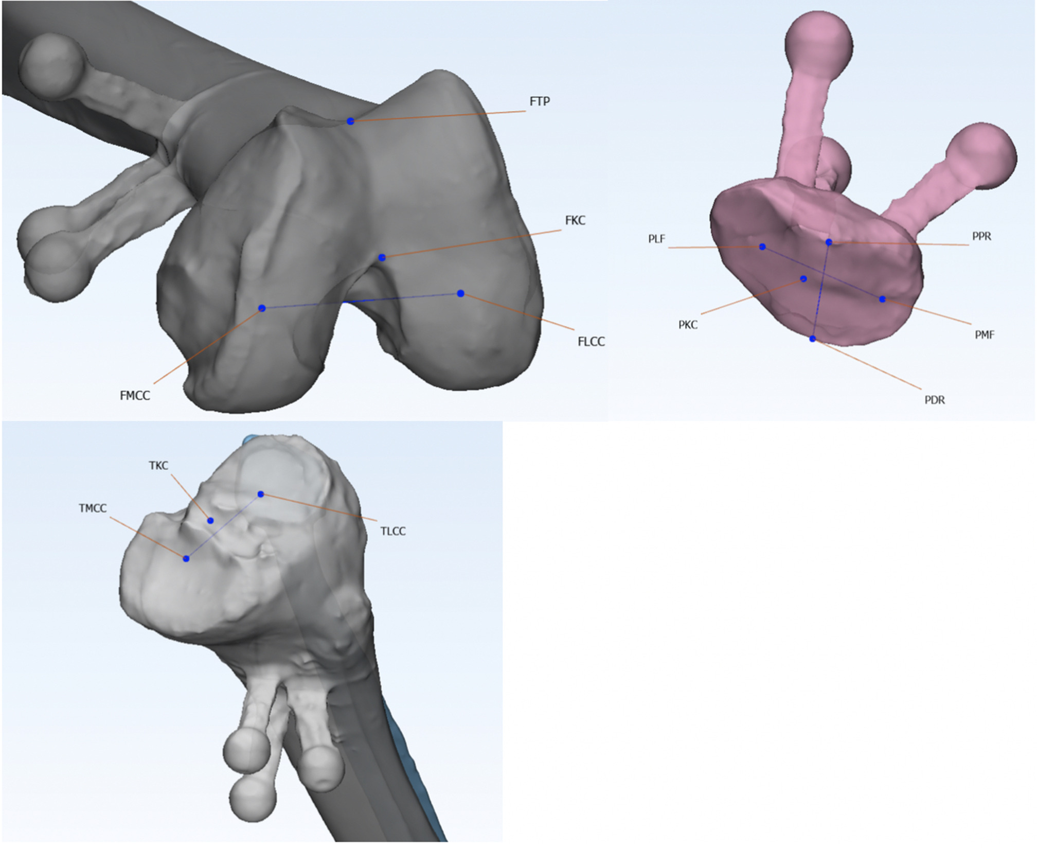 Fig. 3 
            Femoral, tibial, and patellar landmarks: In a clockwise direction, the 3D reconstructions of the femur, patella, and tibia are shown. FKC, centre of the intertrochlear notch; FLCC, centre of the lateral femoral condyle; FMCC, centre of the medial femoral condyle; FTP, deepest point of the trochlea groove; PDR, most distal point of patella's ridge; PKC, centre of the patella; PPR, most proximal point of patella's ridge; TLCC, centre of the lateral tibia plateau; TMCC, centre of the medial tibia plateau.
          