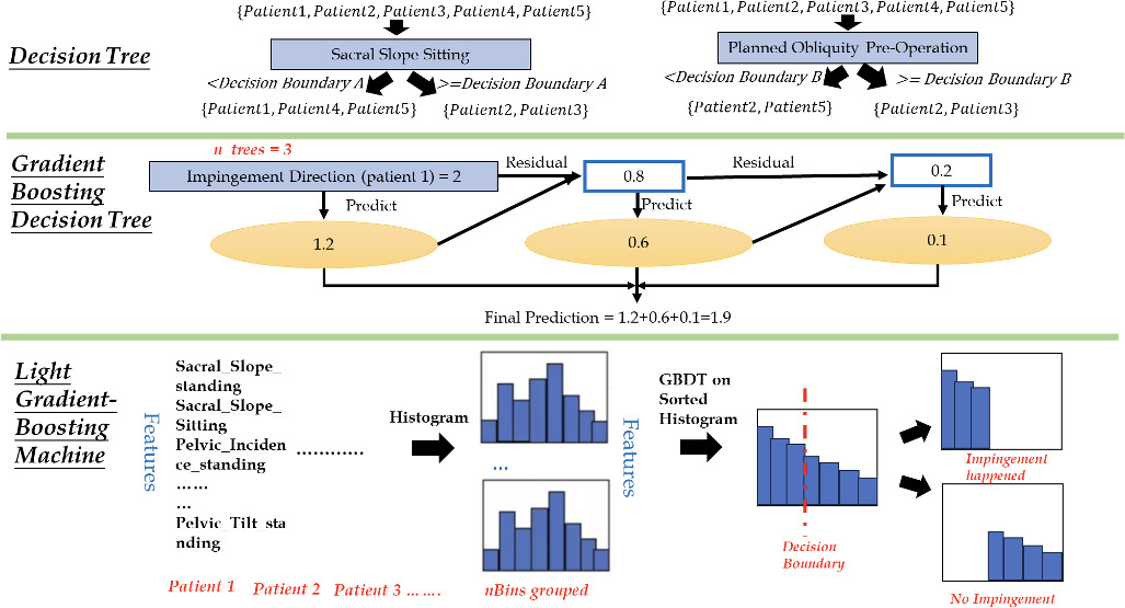 Fig. 1 
            Schematic representation of our artificial intelligence model, illustrating the decision tree, which commences from a distinct feature such as ‘Sacral Slope Sitting’ or ‘Planned Obliquity’. This bifurcates further into leaves based on specific criteria. For example, the left leaf encompasses patients with a ‘Sacral Slope Sitting’ measurement beneath Decision Boundary A, whereas its right counterpart includes those exceeding this. In a hierarchical decision tree, these leaves can split further, based on more features, until the model converges or reaches its maximum depth. Such convergence aligns with predefined metrics integral to information gain. GBDT, Gradient-Boosted Decision Tree.
          