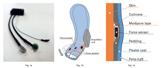 Fig. 1 
        Use of the force sensor. a) Two custom-made inductive sensors were placed on the foot to measure the force of the foot on the cast. b) Wires were routed distally and the acquisition unit was attached to the cast laterally. c) The different layers on the skin.
      