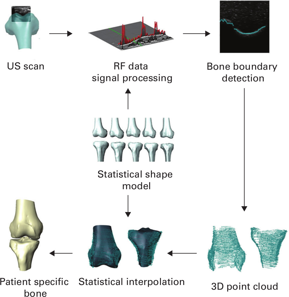 Fig. 2 
            An overview of the bone reconstruction algorithm. RF, radiofrequency; US, ultrasound.
          