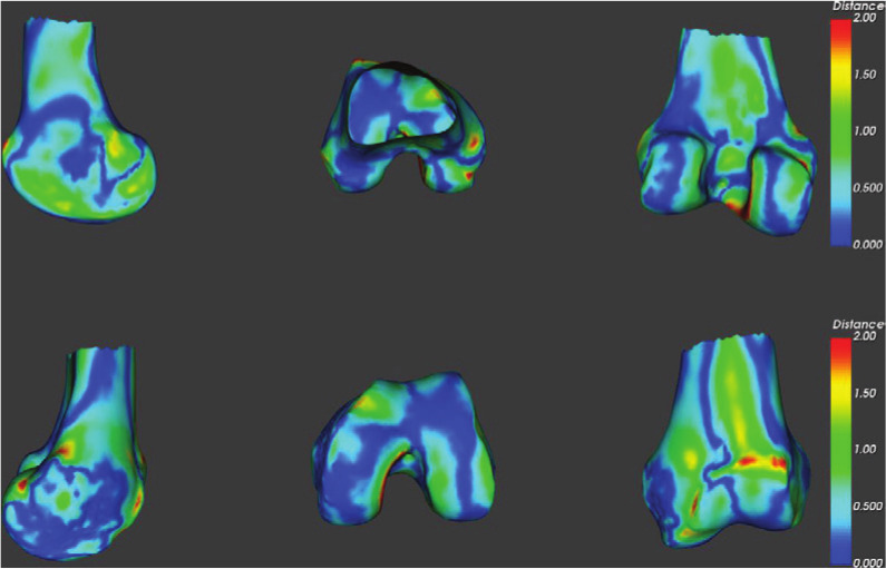 Fig. 4 
          Femoral surface distance map between 3D reconstruction and the CT model.
        