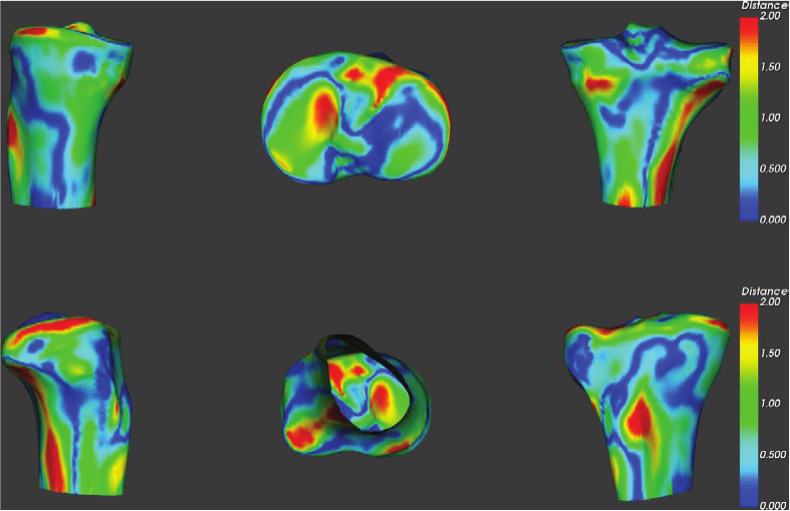 Fig. 5 
          Tibial surface distance map between 3D reconstruction and the CT model.
        