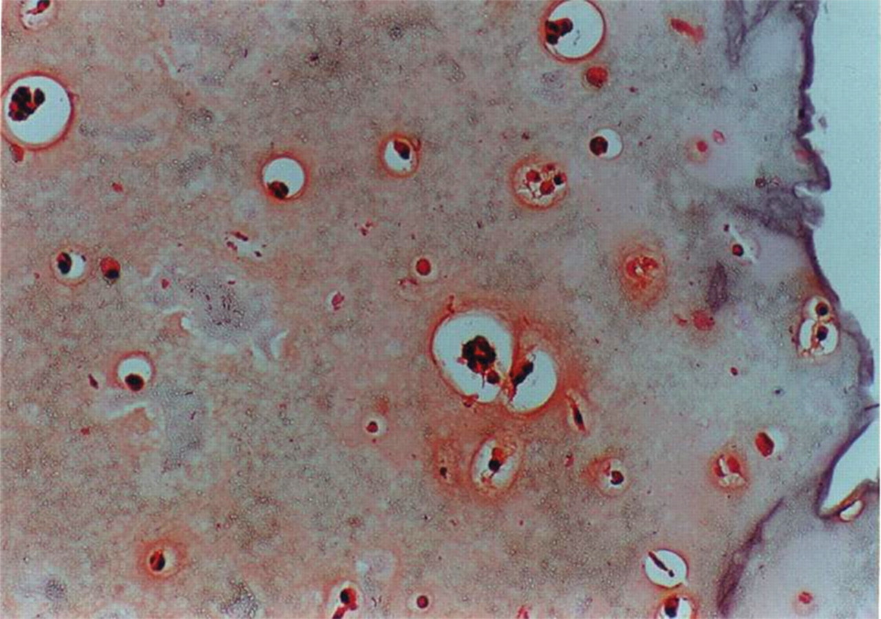 Fig. 5a, Fig. 5b, Fig. 5c, Fig. 5d  
            Photomicrographs of human chondrocytes in alginate beads at day 14 in Safranin-O stain (x 20 magnification). a) in static culture, centre of the bead; b) in rotating wall vessel (RWV) bioreactor, centre of the bead; c) in static culture, peripheral edge of the bead and d) in RWV bioreactor, peripheral edge of the bead.
          