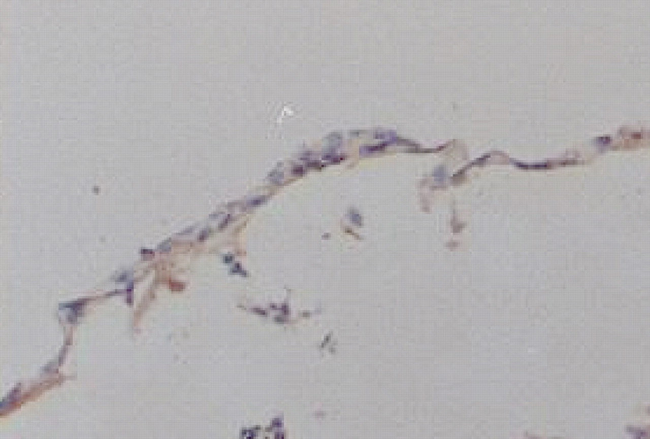 Fig. 7a, Fig. 7b  
            Photomicrographs showing collagen type-I staining in a) bovine static culture and b) human static culture.
          