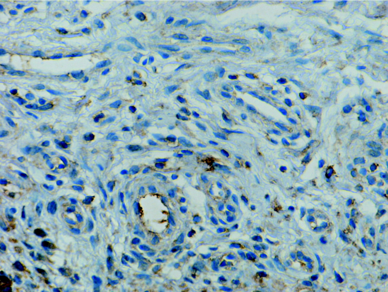 Fig. 2  
            CD3 T cells. Photomicrograph of immunocytochemistry, magnification ×400.
          