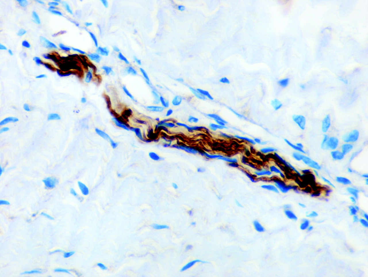 Fig. 7  
            S100 nerve tissue. Photomicrograph of immunocytochemistry, magnification ×400.
          