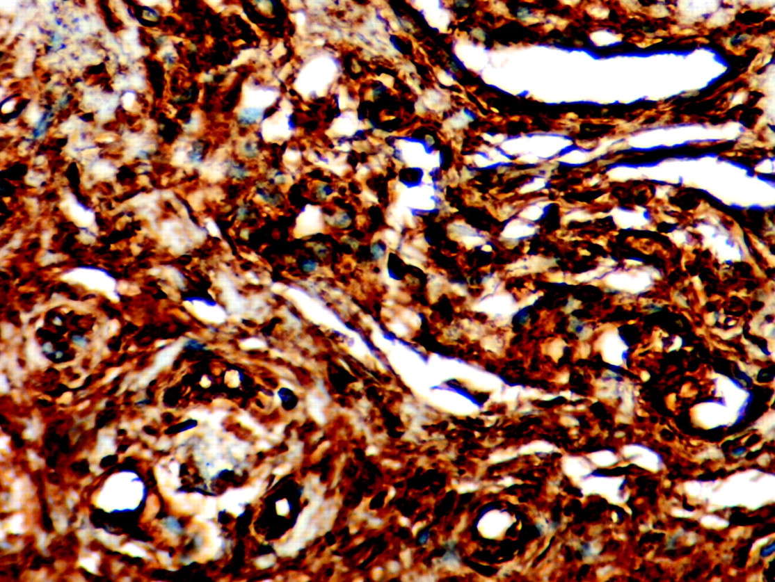 Fig. 8  
            Vimentin fibroblasts. Photomicrograph of immunocytochemistry, magnification ×400.
          