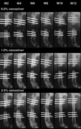 Fig. 2 
          Radiographic images of 108 CFUs Staphylococcus
aureus Mu50-infected rat femoral segmental defects implanted
with 0.0%, 1.0% and 2.0% nanosilver–polylactic-co-glycolic acid
bone grafts coupled with 30 mg/ml bone morphogenetic protein-2.
From left to right at weeks 2, 4, 6, 8, 10 and 12. Reprinted from
Biomaterials, 31 Zheng Z, Yin W, Zara JN, et al. The use of BMP-2
coupled - Nanosilver-PLGA composite grafts to induce bone repair
in grossly infected segmental defects, 9293-9300; 2010 with permission
from Elsevier.
        