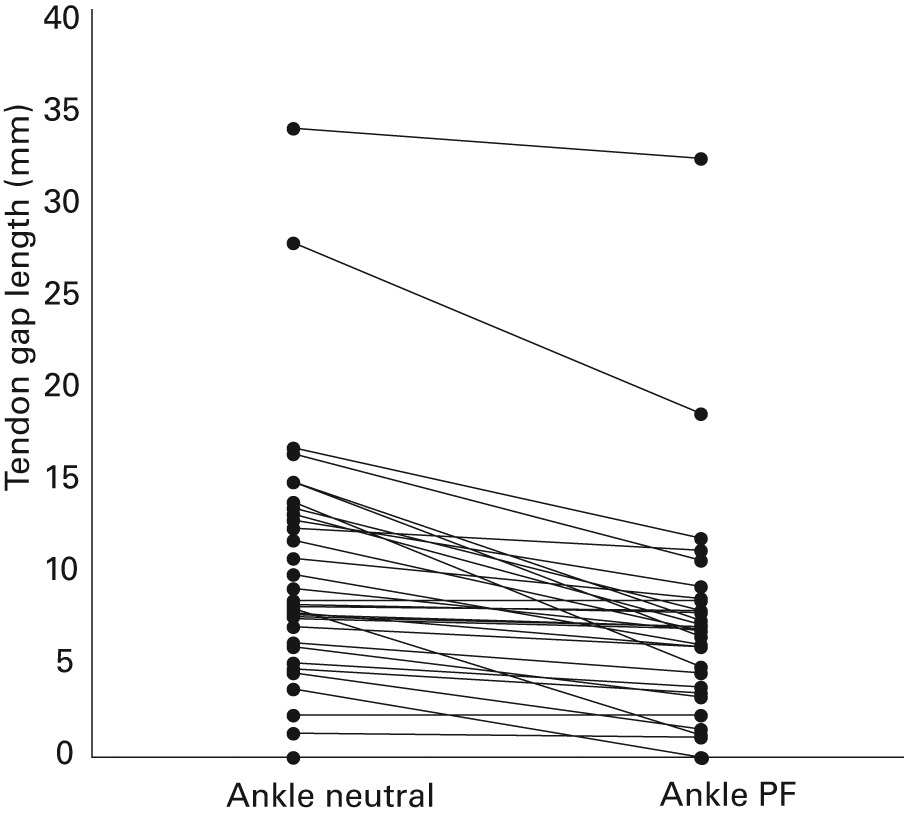 Fig. 2 
            Plot showing distance between tendon
ends with the ankle in both neutral and plantar flexion (PF), with
the knee in extension for each patient.
          