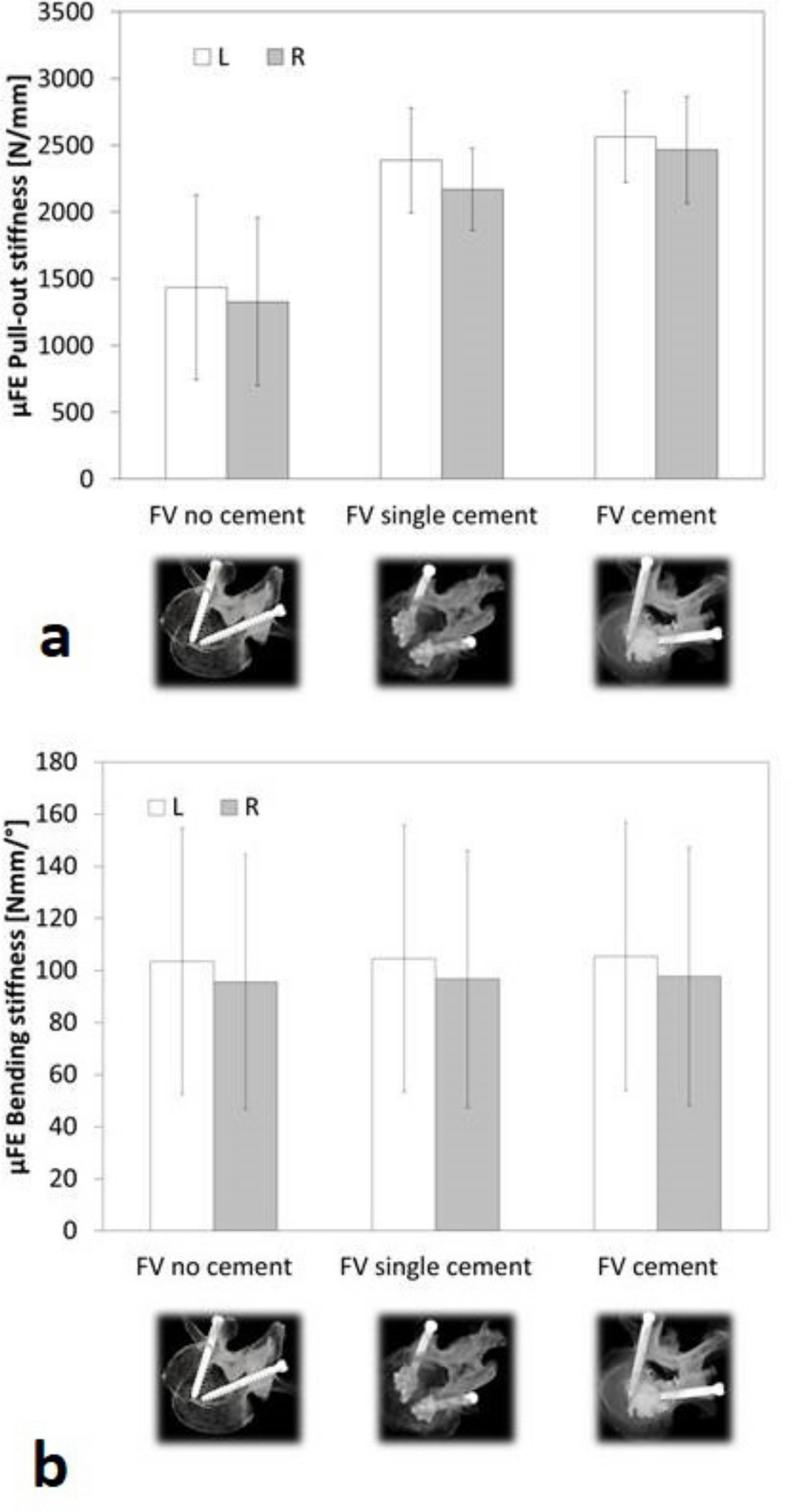 Fig. 6 
            The effect of different cement augmentation scenarios on the mean predicted stiffness in a) pull-out and b) bending from the full vertebral models. FV, full vertebra; L screw, Ennovate screw; R screw, S4 screw; µFE, microfinite element.
          