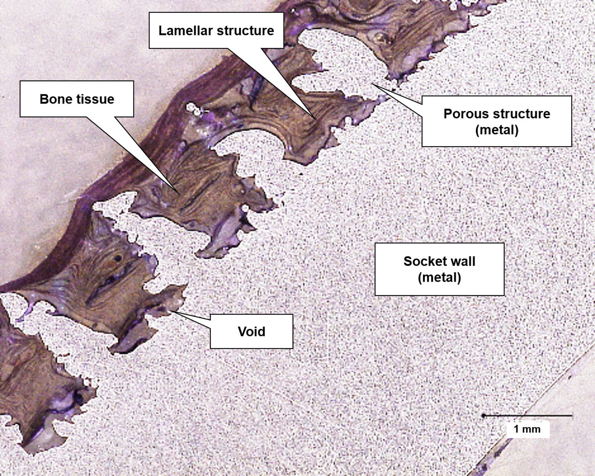 Fig. 6 
            Image captured from a histological section obtained from one of the 3D-printed implants; the lamellar structure of bone is visible. The different regions on the slice are specified (staining: Toluidine Blue, Paragon; magnification 50×).
          