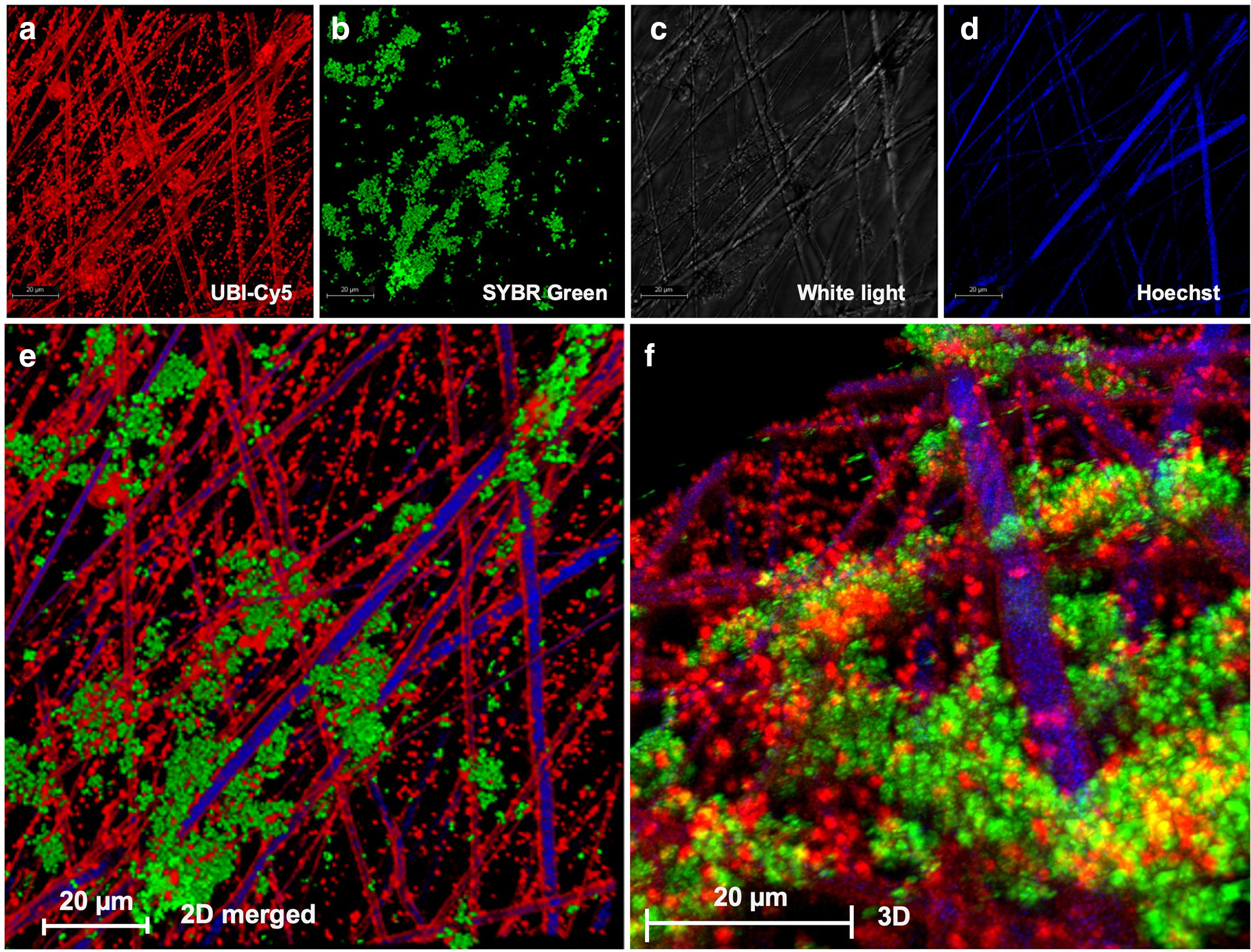 Fig. 2 
            Fluorescence confocal microscopy images of scaffolds containing bacteria in an associated biofilm matrix. a) Stapylococcus aureus is stained with UBI29-41-Cy5 (red) and b) biofilm-associated matrix is stained with SYBR Green. c) The 2D white light image of scaffold fibres and scaffold fibres stained with d) Hoechst (blue). A merged image is shown in e), and a 3D image is shown in f).
          