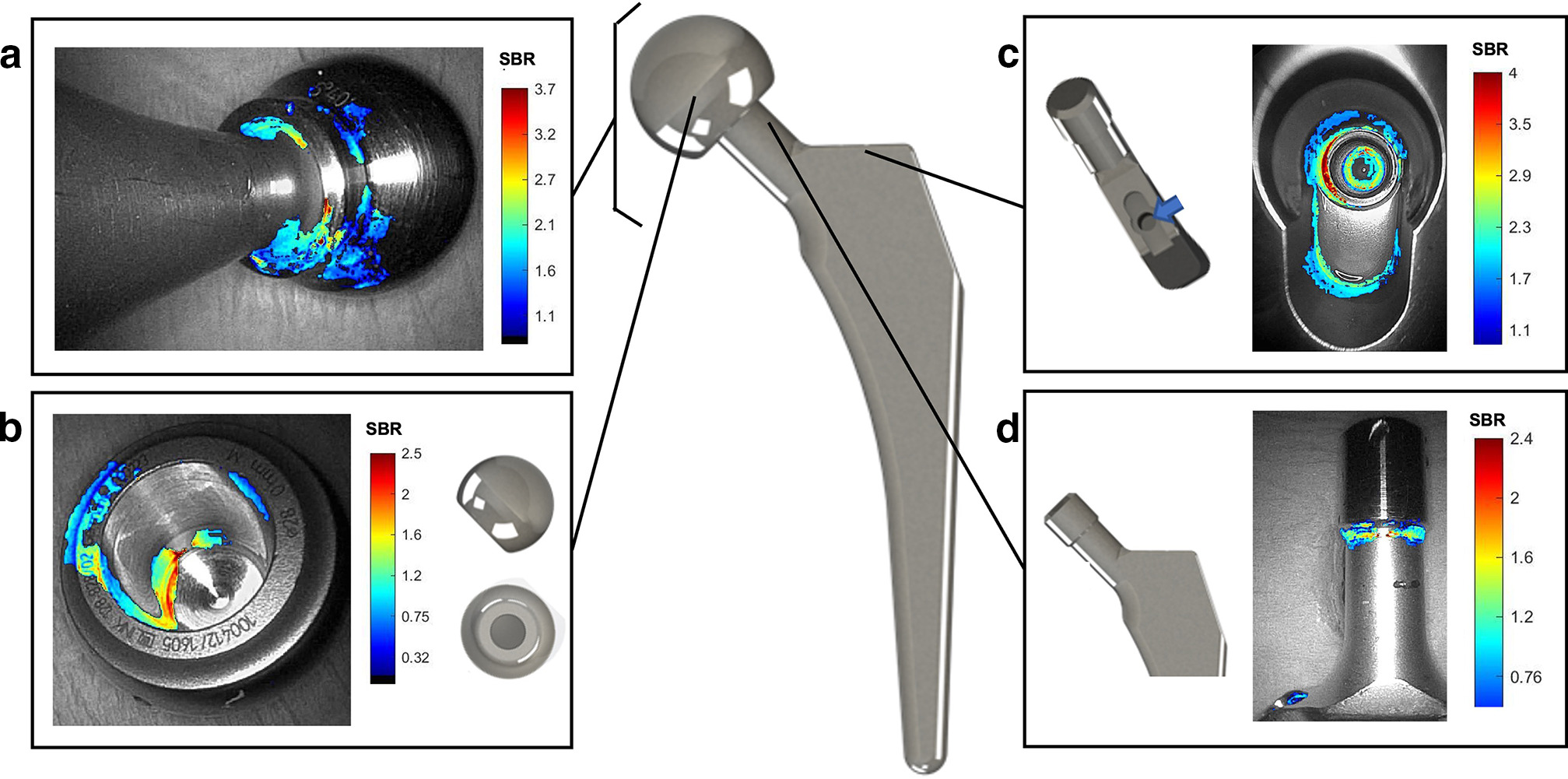 Fig. 3 
            Visualization of bacterial infection on a femoral prothesis. Representative pseudo-coloured fluorescence imaging of Stapylococcus aureus with UBI29-41-Cy5 of bacterial growth on various locations on femur prosthetic implants: a) connected head and neck of the prosthesis; b) femoral head; c) prosthesis ‘shoulder’ with screw hole; and d) junction between femoral neck and taper (for femoral head fixation). SBR, signal-to-background ratio of fluorescence intensity with accompanying scale bar. n > 8.
          